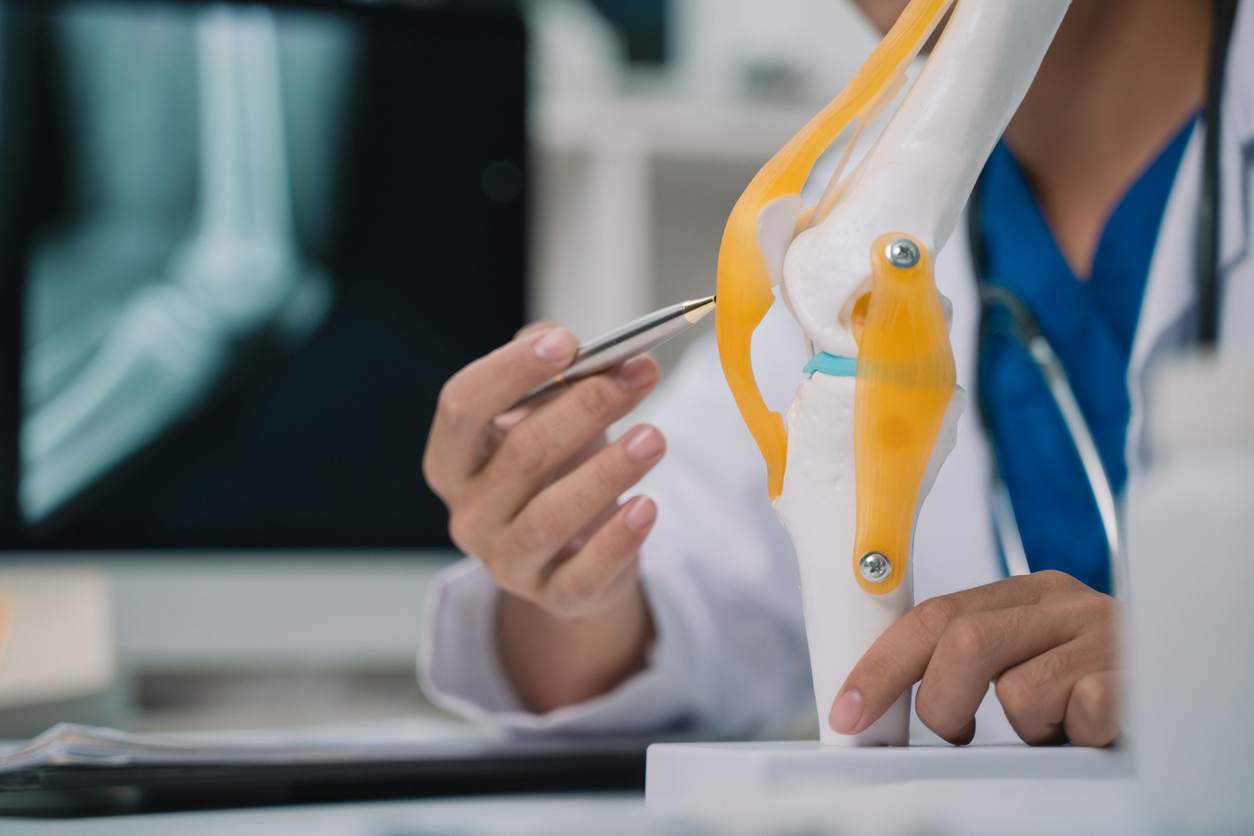 Orthopädie, Traumatologie, Sportmedizin, Behandlung, Arzt, Konsultation, Knie, Knieverletzung